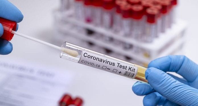 मोठा निर्णय : आता फेरीवाले व दुकानदारांची होणार कोरोना चाचणी