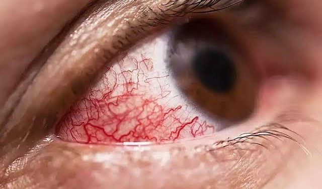 महात्मा ज्योतिराव फुले जन आरोग्य योजनेतंर्गत